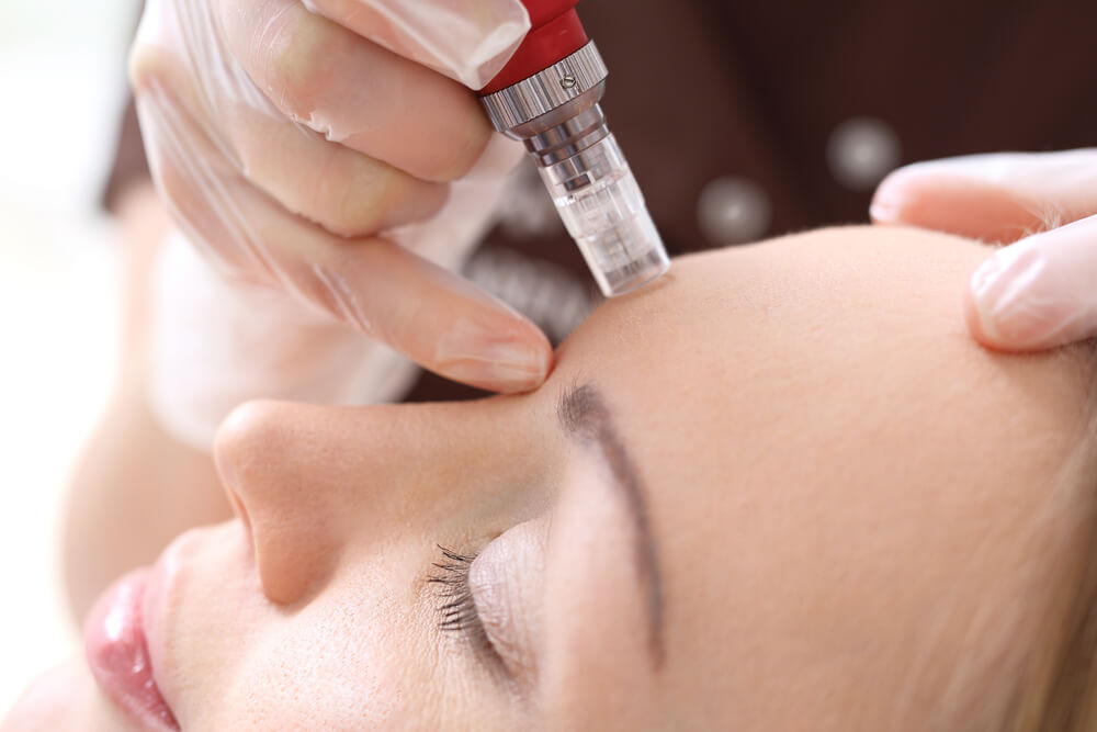 Mesotherapy