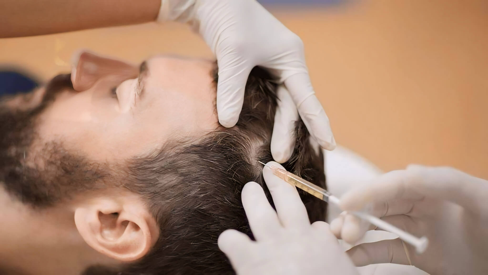 PRF Hair Restoration